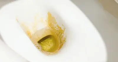 Toilet limescale melts away overnight with 1 natural item