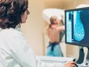 Breast cancer screening misses 95% of at-risk women under 50