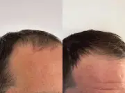 Caudalie Anti-Hair Loss Serum: Shopper Reports Less Hair Loss After Two Weeks