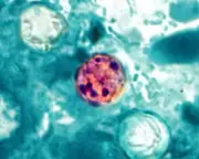 Cyclospora outbreak kills two in Michigan, officials say