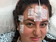 Epilepsy Patient Faces Brain Surgery After Misdiagnosis