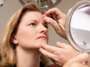 Facelifts rise among women in 30s and 40s, surgeon says