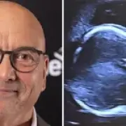 Gregg Wallace fans warn him over ultrasound post revealing private details