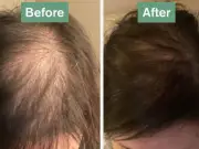 Hair Saviour: 78p-a-day supplement praised by shoppers