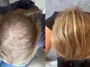 Hair Thickening Shampoo Duo Praised by Shoppers Now £25.50