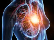Heart attack care 'revolution' after women ignored for decades