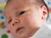 How to spot and treat heat rash in babies during heatwave
