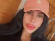 Influencer with 'Britain's biggest lips' injects own filler after clinics refuse