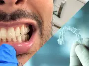 Invisalign Myths Busted by Man's Incredible Smile Transformation