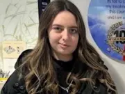 Liverpool woman unable to move face after cancer surgery