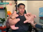 Man with 9kg hands reveals why he refused surgery as a child