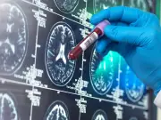 Manchester scientists find window to stop deadly brain cancer returning