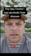 Man's Eyes Turned Yellow at 25 After Years of Alcohol Abuse Including Hand Gel