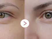 Medicube Eye Serum reduced to £9.99 on Amazon