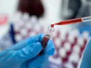 Men over 50 lose automatic right to free PSA tests