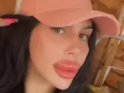 Model injects own lip filler at home despite blindness warnings