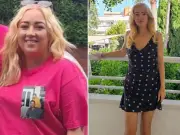 Mounjaro hair loss left her less confident than when 8 stone heavier