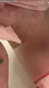 Mum's shock as daughter's rash turns out to be life-threatening condition