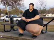 My 600lb Life star JT's 100lb growth ordeal and his life now