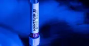 New hantavirus case in Europe after holiday in France