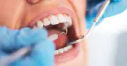 NHS dentist: Millions unaware of permanent registration myth