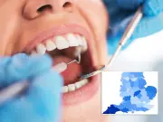 NHS dentistry 'lost' as 600 practices go private, study finds