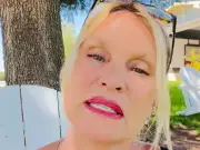 Nicollette Sheridan hospitalised after dog accident causes third-degree rope burns