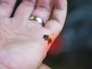 Nurse explains wasp and bee sting symptoms you should not ignore