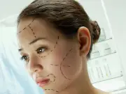 Nurse fears teens will be next wave of botched Turkey surgery victims