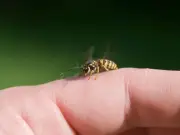 Nurse reveals warning signs of serious wasp and bee sting allergy