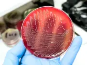 Salmonella case in Wales amid UK outbreak linked to imported eggs