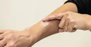Scientist Explains Why Mosquito Bites Affect People Differently