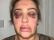 Serial domestic abuser jailed for violent attack on ex-partner