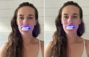 SmilePro LED teeth whitening kit review: 7-day test results