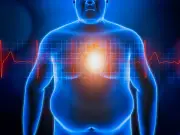 Study: Visceral fat worse for heart health than BMI