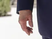Trump's 'mangled hand' sparks fresh health speculation online