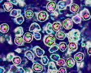 Two unvaccinated people die of measles in Pennsylvania