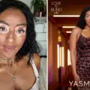 Vitiligo on Love is Blind UK: A Personal Reflection on Representation