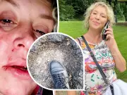 Woman 48 left with life changing injuries after pothole trip