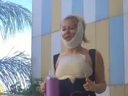 Woman compares herself to 'Frankenstein's bride' after full-body makeover