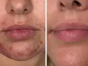 Woman ditches foundation after using £30 'desert island' spot gel