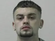 Woman left with skull fractures after boyfriend's false flirting accusations