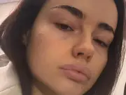 Woman spent £8k on Love Island look and now hates her face
