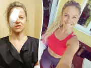 Woman's 'flickering lights' at work led to rare eye cancer diagnosis