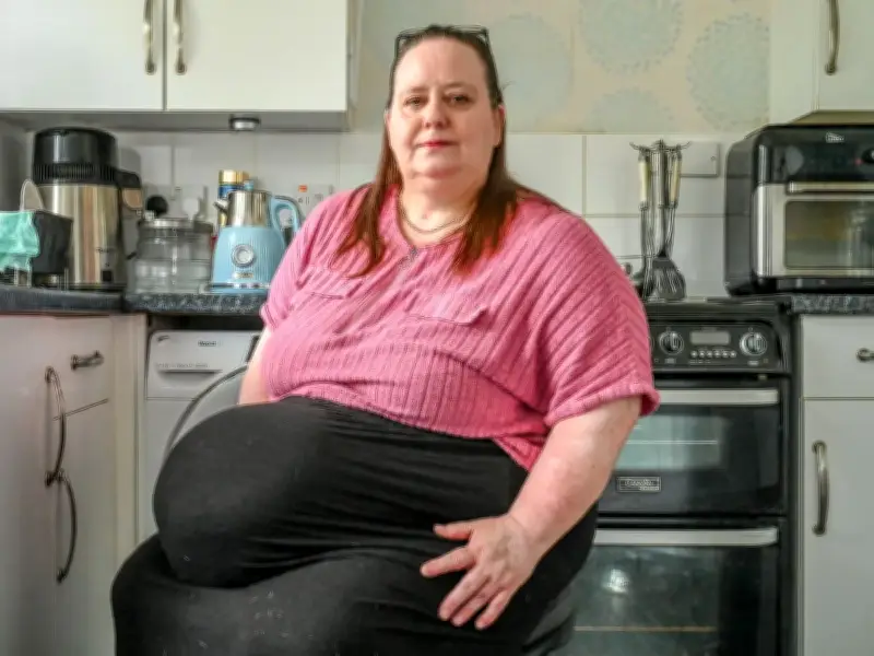 Mum with 'biggest hernia doctors have ever seen' turns to Mounjaro to be approved for life-changing surgery