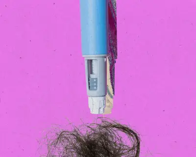GLP-1 Hair Loss: What You Need to Know