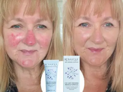Mature beauty buffs 'feel younger' after trying 'confidence-boosting' £25 cream