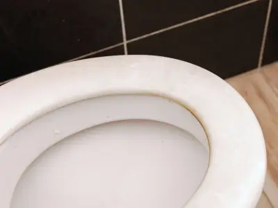Toilet seat stains vanish in 30 minutes with natural 2-ingredient solution