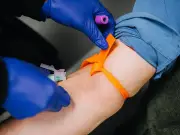 Bladder cancer symptoms often mistaken for common infection