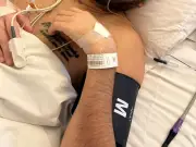 Crash survivor lives with 3D-printed skull after scooter hit
